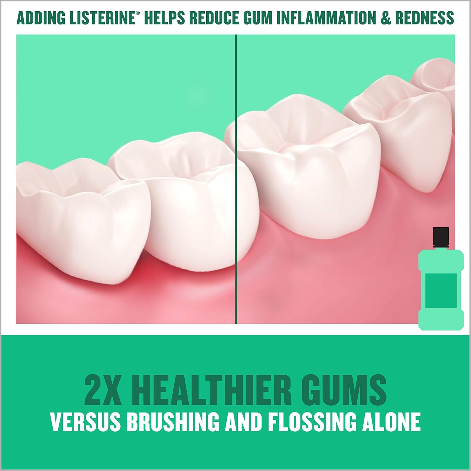 Listerine Freshburst Antiseptic Mouthwash with Germ-Killing Oral Care Formula to Fight Bad Breath, Plaque and Gingivitis, 500 mL : Beauty