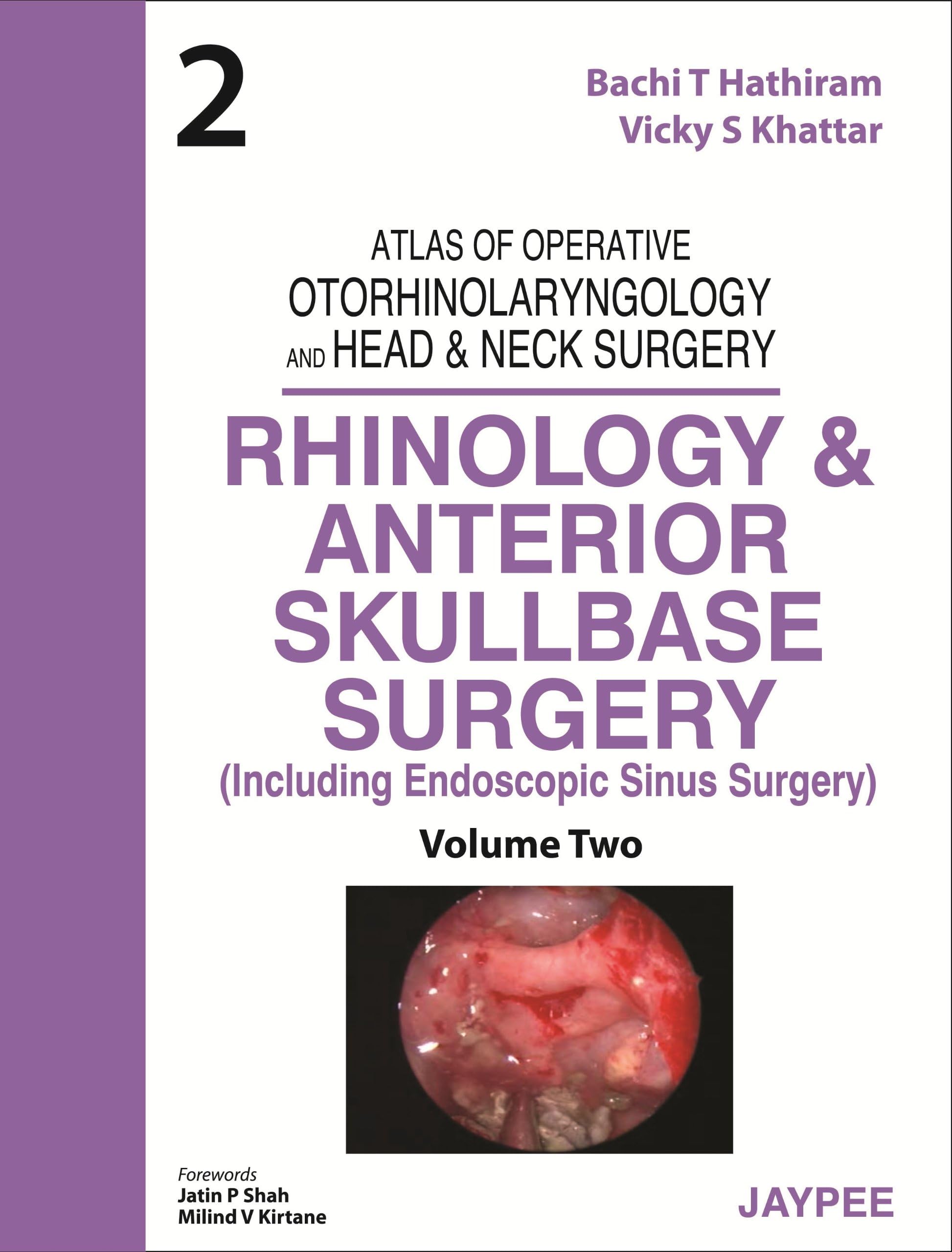 Atlas of Operative Otorhinolaryngology and Head & Neck Surgery (Volume-2): Rhinology and Anterior Skullbase Surgery
