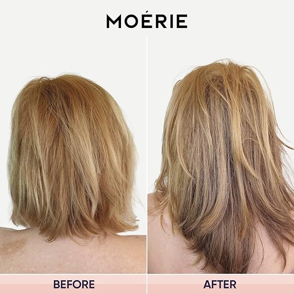 MOERIE ULTIMATE HAIR GROWTH CONDITIONER – FOR LONGER, THICKER, FULLER HAIR – VEGAN FRIENDLY VOLUMIZING HAIR PRODUCTS – PARABEN & SILICONE FREE – ALL HAIR TYPES – REVERSE HAIR LOSS – 8.45 FL OZ (250ML)