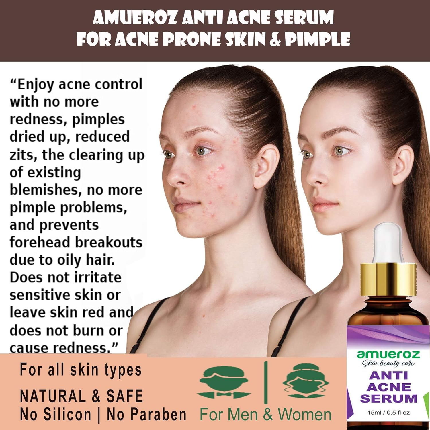 amueroz anti acne serum