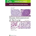 Biopsy Interpretation of the Lung (Biopsy Interpretation Series)