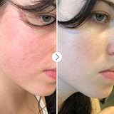Pai Skincare THE LIGHT FANTASTIC Ceramide Night Oil Rosacea-Prone Sensitive 10ml view 4