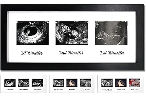 IHEIPYE Triple Sonogram Pregnancy Frame – Baby Ultrasound Picture Frame with Story for Expecting Parents, Baby Shower Frame, Baby Grow Through All Three Trimesters Frame, Nursery Decor, Black