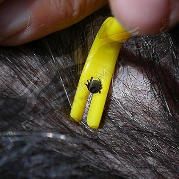 Pets Empire 2pcs Deer Tick Remover Small & Large Set - Easy 2-in-1 Removal Tool And Hook Fast Treatment & Extractor Tool For Dogs, Humans And Cats. Easily Sterilize, Clean & Small Enough For All Types Of Travels. 2 Pcs Color May Vary