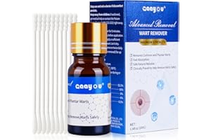 VIVABLOOM Fast-Acting 17% Salicylic Acid Wart & Mole Remover Liquid for Feet - Maximum Strength Plantar Wart, Corn & Callus Remover, Invisible Skin Tag Removal Kit for Hands & Toes (10ml, Men/Women) (1)