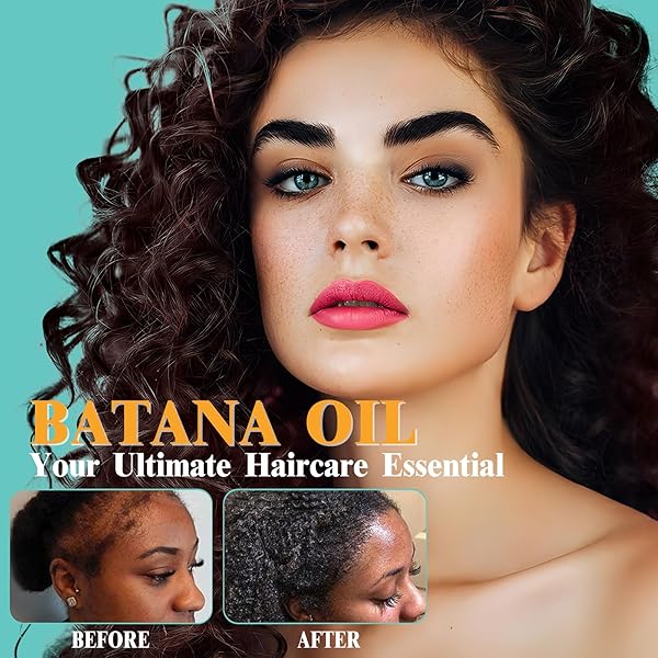 QLASIC 100% RAW BATANA OIL FOR HAIR GROWTH，RAW BATANA OIL FOR HAIR GROWTH AND REPAIR -100% PURE, UNREFINED FROM HONDURAN RAINFORESTS PREVENT HAIR LOSS AND ENHANCES HAIR THICKNESS IN MEN & WOMEN
