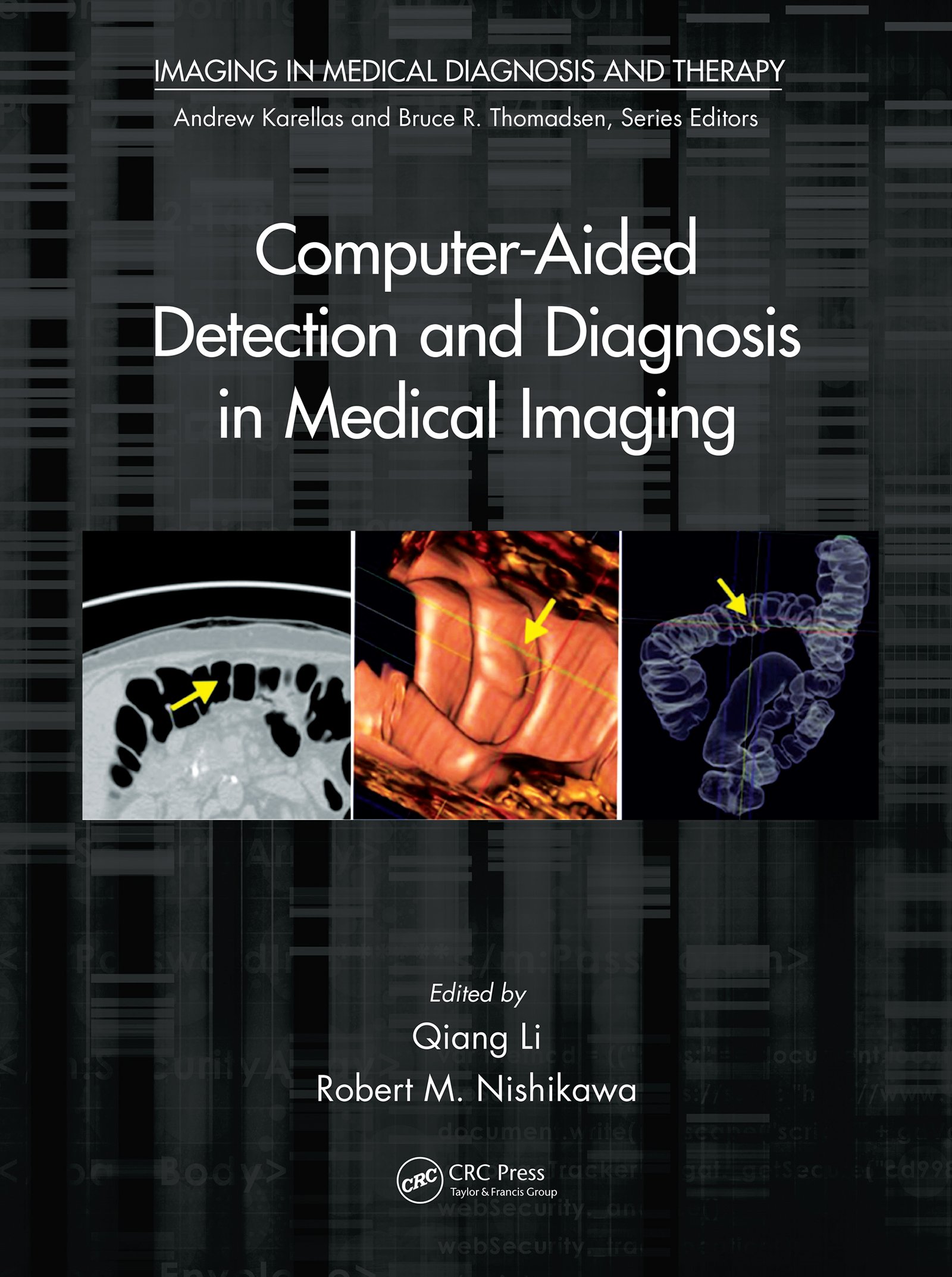 全商品オープニング価格 特別価格 Computer Aided Detection Imaging Medical In Diagnosis And 38824075