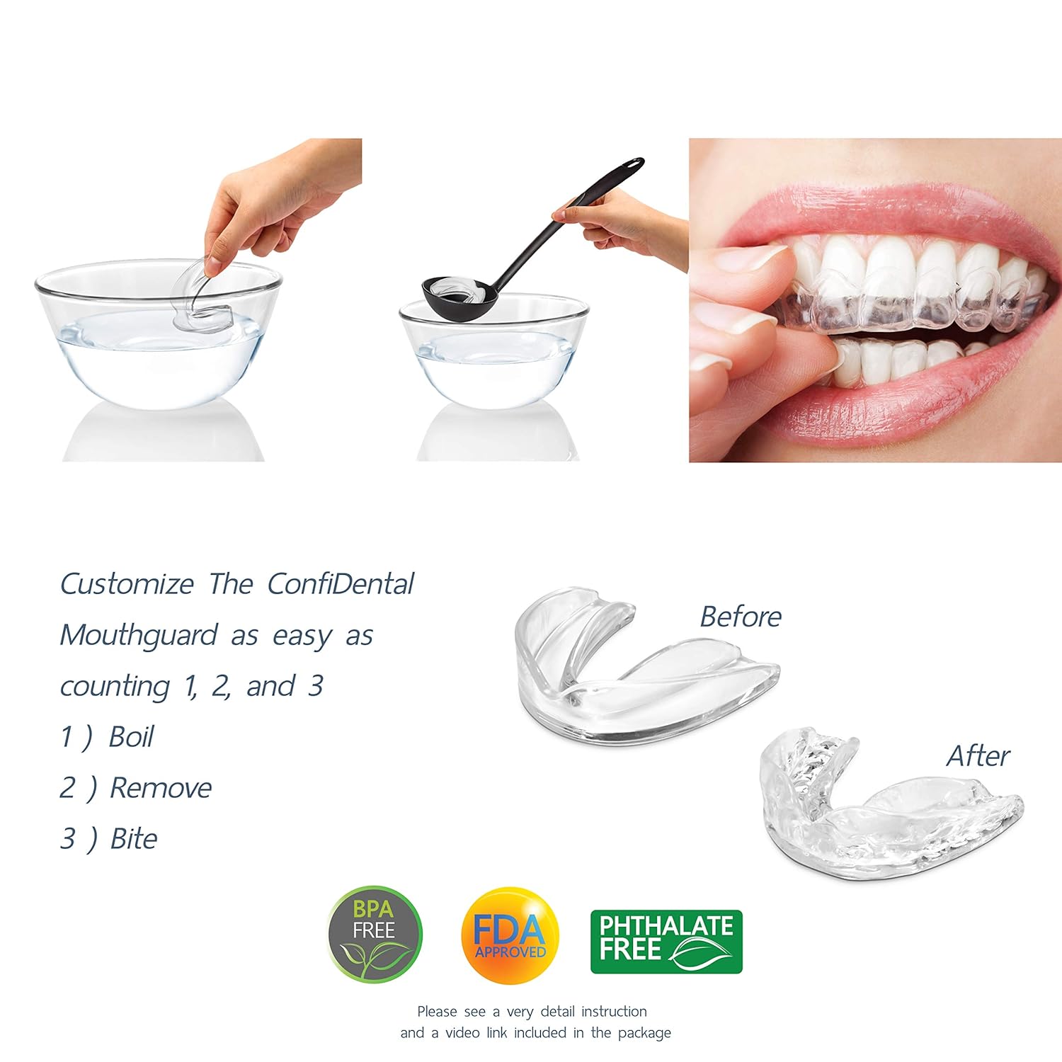 The ConfiDental - Pack of 5 Moldable Mouth Guard for Teeth Grinding Clenching Bruxism, Sport Athletic, Whitening Tray, Including 3 Regular and 2 Heavy Duty Guard (3 (lll) Regular 2 (II) Heavy Duty) : Beauty