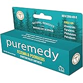 Puremedy - Eczema & Psoriasis Relief Ointment, All-Natural Salve Soothes and Relieves Symptoms of Dry Itchy Flaky Scratchy or Weepy Skin - 0.5 oz