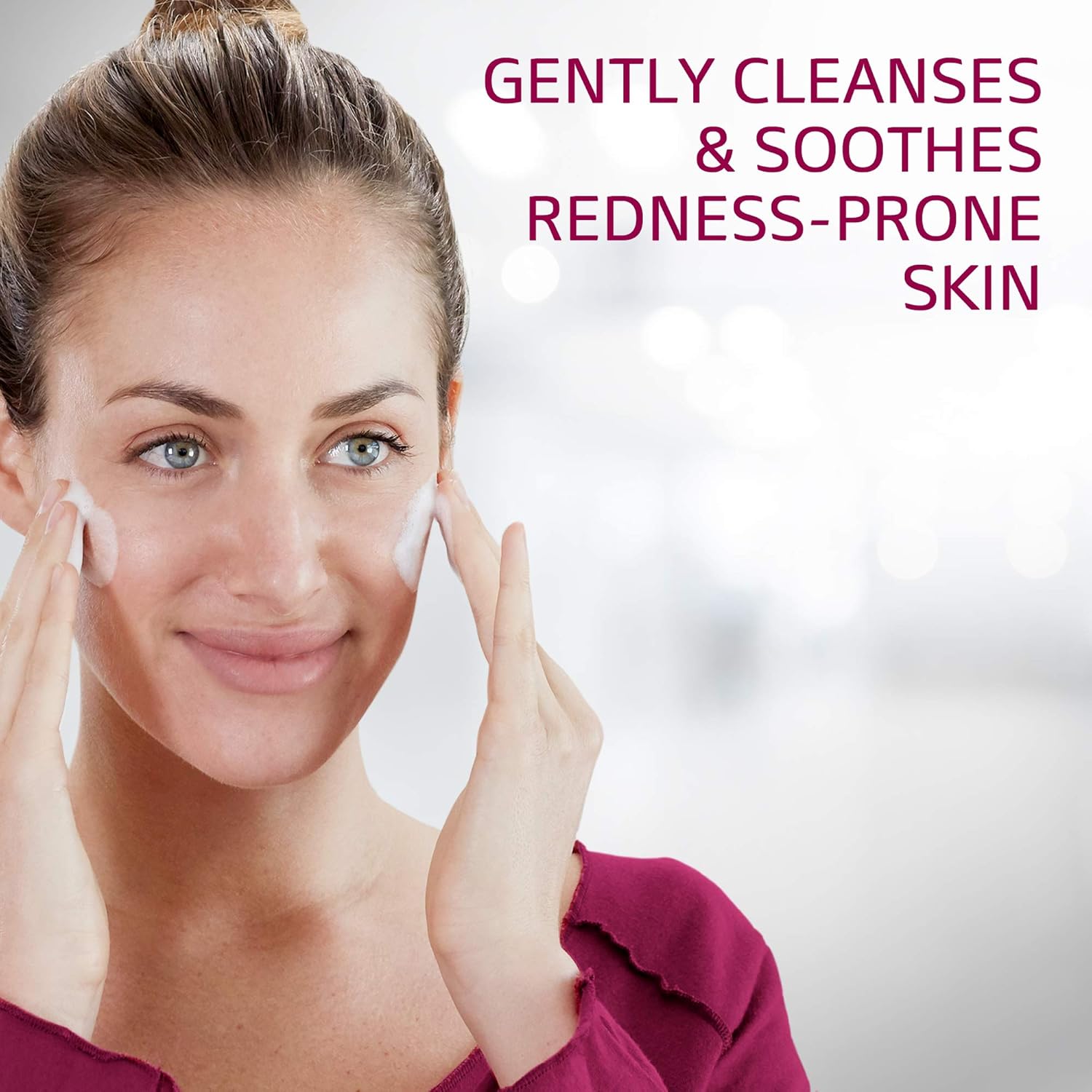 skin prone to redness