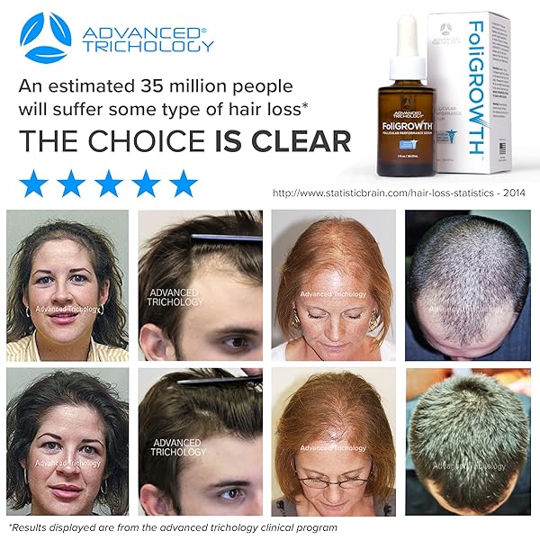 ADVANCED TRICHOLOGY FOLIGROWTH™ FOLLICULAR PERFORMANCE SERUM FOR THICKER FULLER HAIR | TRIPLE-ACTION, MULTI-ZONAL TOPICAL SERUM FOR HORMONAL, NUTRITIONAL, AND INFLAMMATORY-RELATED HAIR