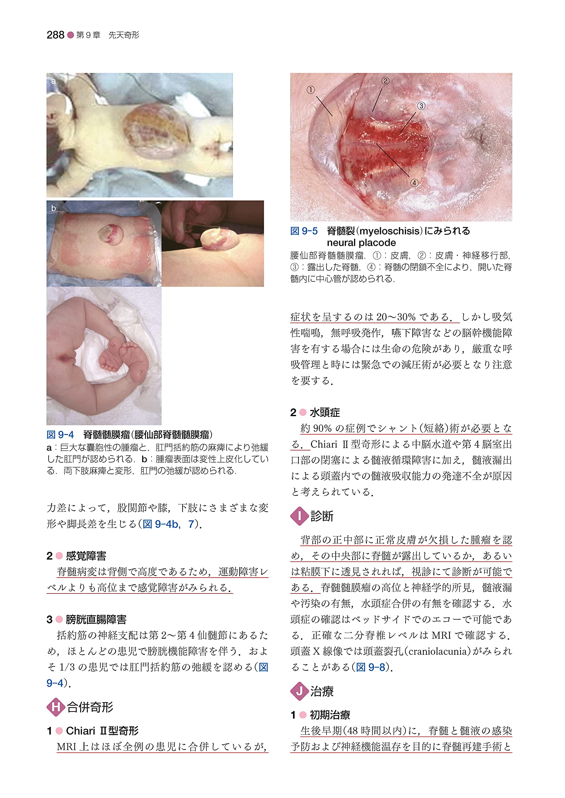 標準脳神経外科学 第15版 Standard Textbook Amazon Com Books