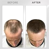 THICK FIBER Hair Fibres Medium Brown 25g Bottle for Thinning Hair view 6