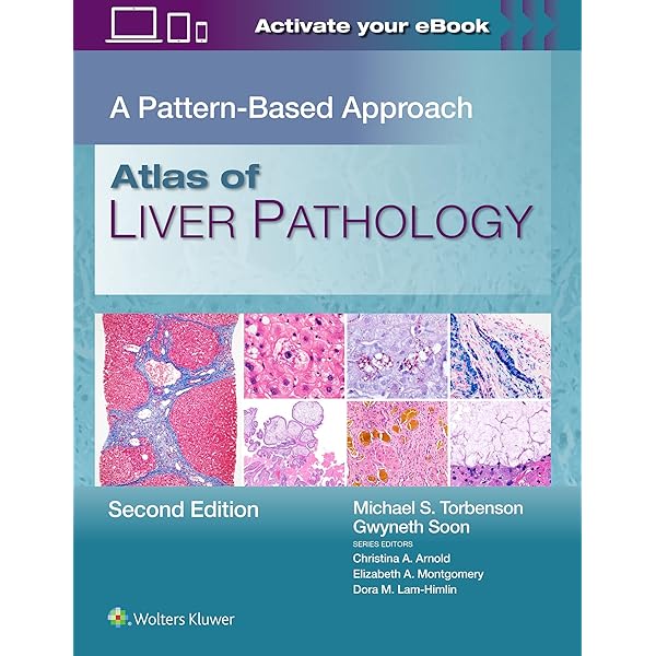 MacSween's Pathology of the Liver: 9780702082283: Medicine