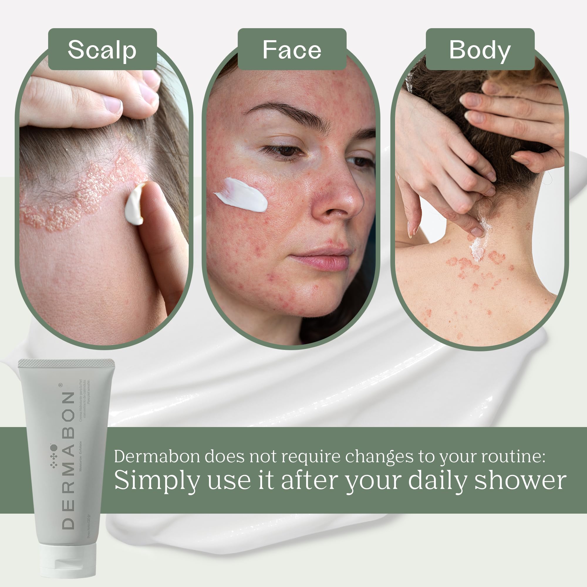 Dermabon Seborrheic Dermatitis Cream, Eczema & Psoriasis Treatment - Calendula Extract, Salicylic Acid, Bee Wax -Soothes, Hydrates & Balances Skin Tone - Moisturizing & Skin Relaxing Relief