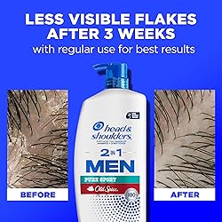 Head & Shoulders 2-in-1 Dandruff Shampoo and