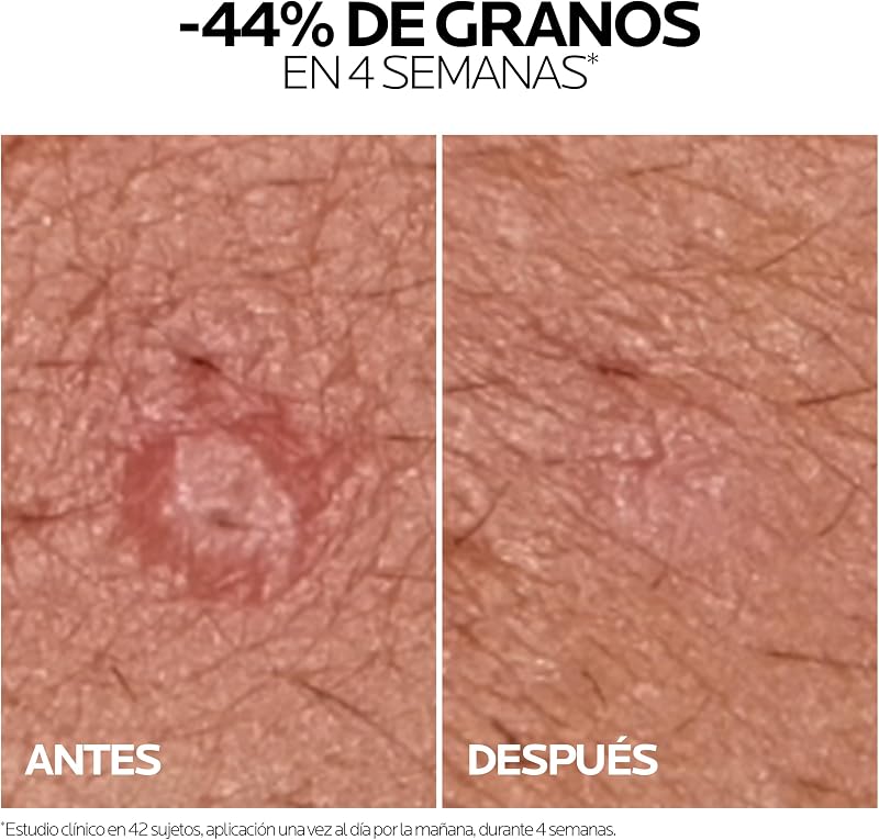 , Effaclar Duo+M, Gel crema corrector triple, 40 ml