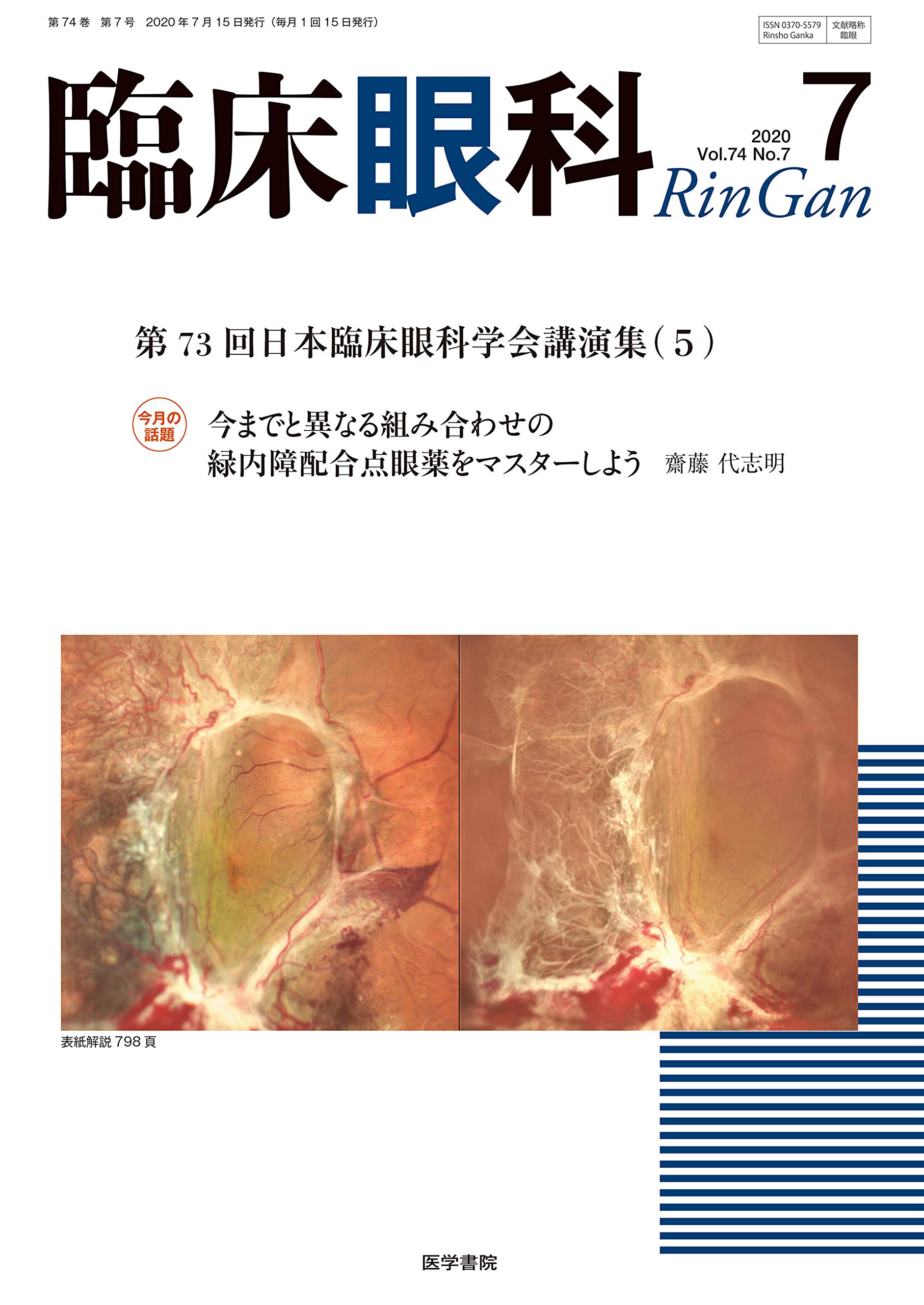 臨床眼科 2020年 7月号 特集 第73回 日本臨床眼科学会講演集 5 本 通販 Amazon