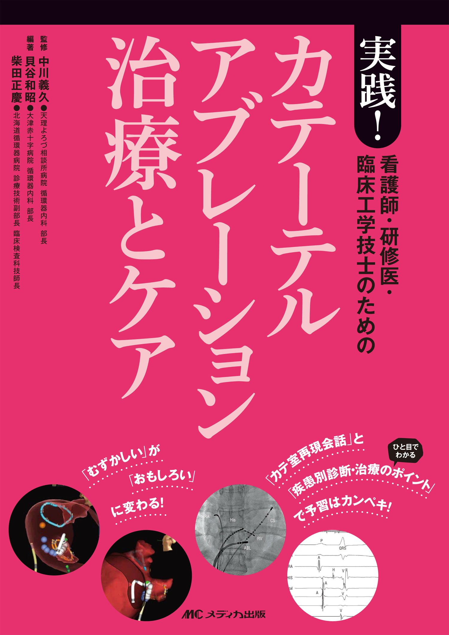 看護師 研修医 臨床工学技士のための実践 カテーテルアブレーション治療とケア むずかしい が おもしろい に変わる カテ室再現会話 とひと目でわかる 疾患別診断 治療のポイント で予習はカンペキ 貝谷 和昭 柴田 正慶 中川 義久 貝谷 和昭 柴田