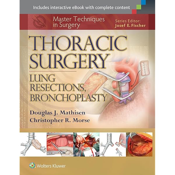 Master Techniques in Surgery: Thoracic Surgery: Transplantation
