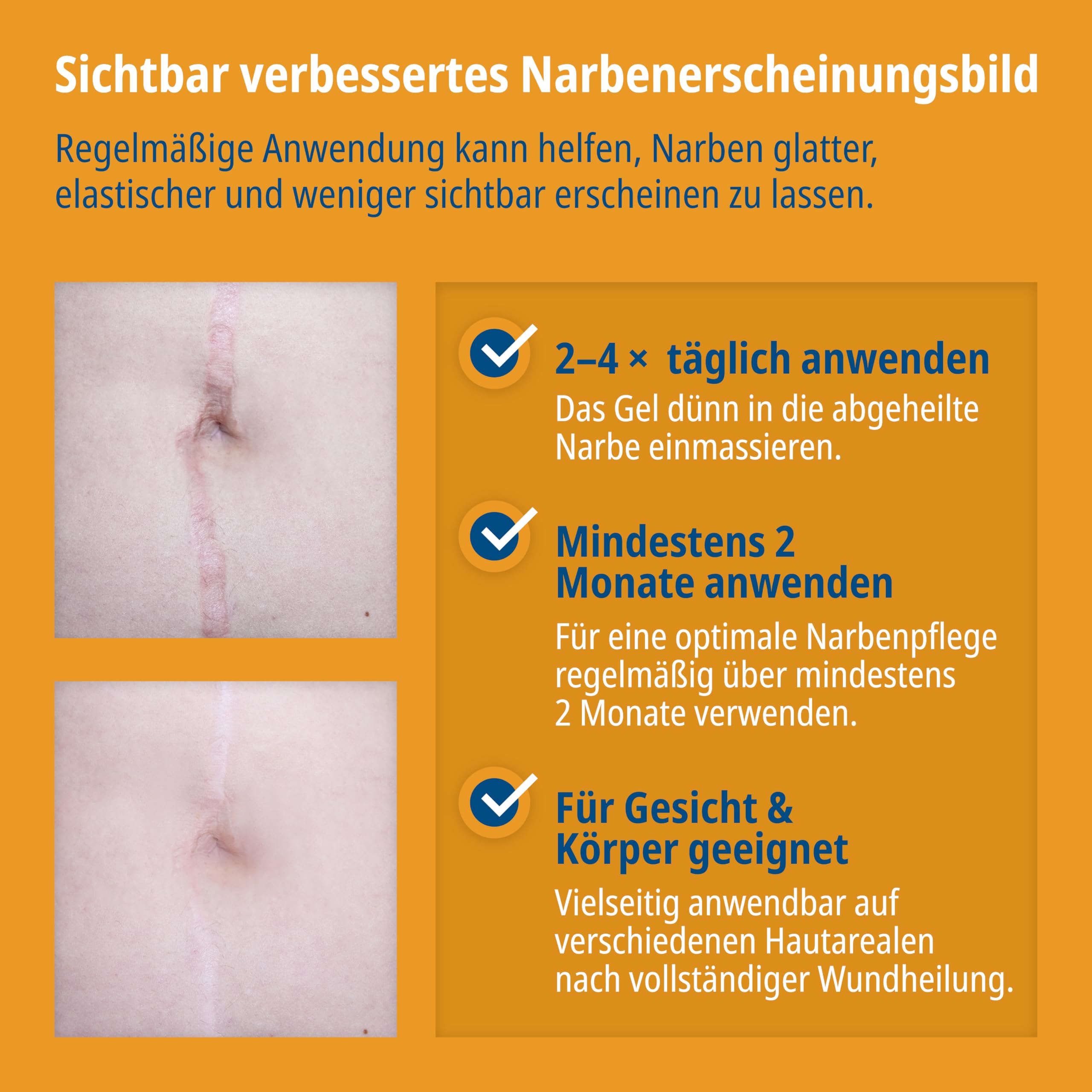 Evolsin® Narbengel für Kinder & Erwachsene, 20 g 6