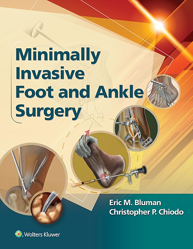 Download Minimally Invasive Foot & Ankle Surgery (Minimally Invasive Orthopaedic Surgery) (English Edition) PDF