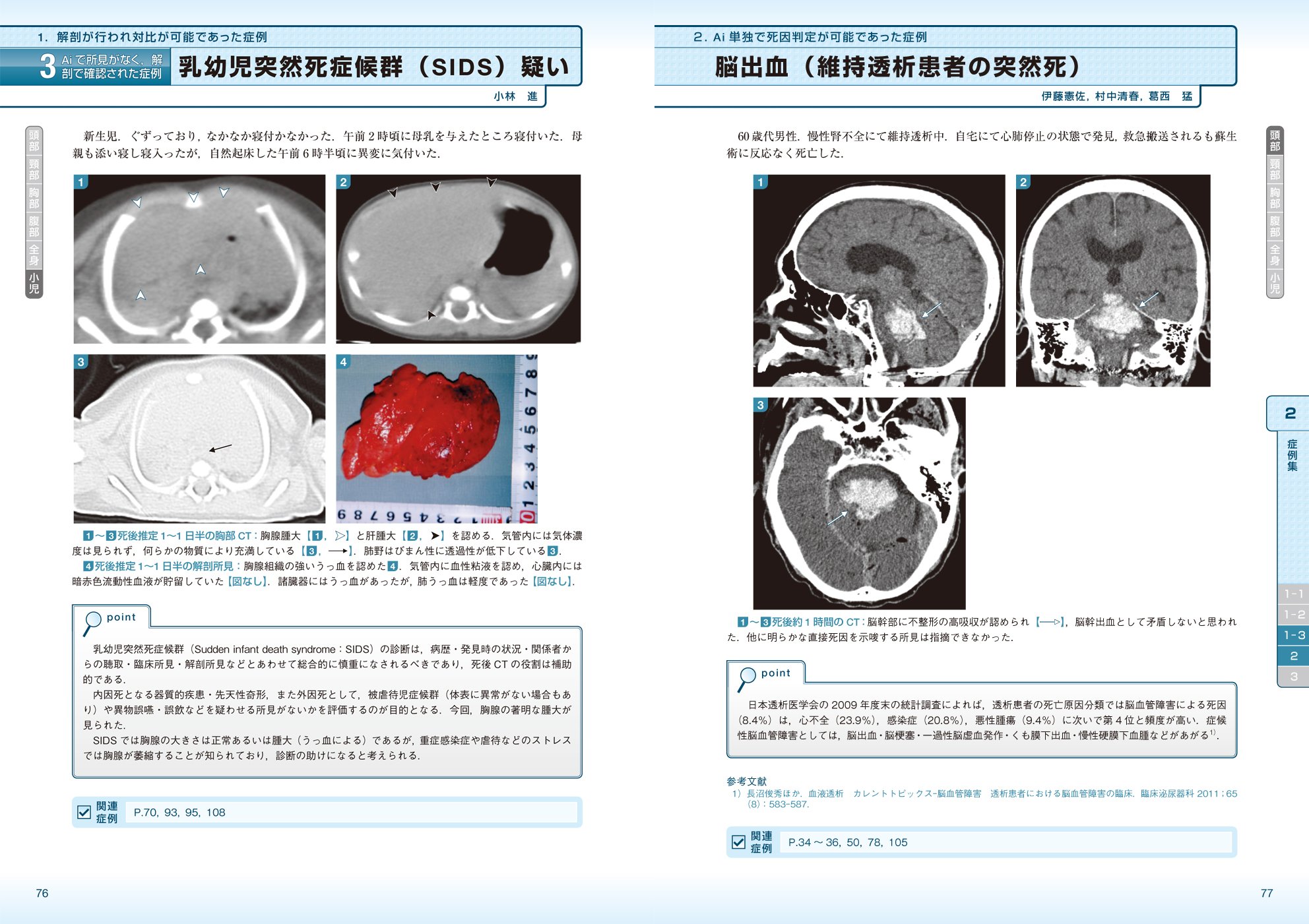 Autopsy Imaging 症例集 死亡時画像診断のための読影マニュアル 高橋 直也 塩谷 清司 本 通販 Amazon