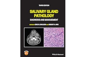 Salivary Gland Pathology: Diagnosis and Management