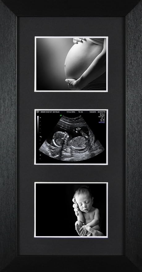Maison Decoration D Interieur Ulrasound Grossesse Bebe Scanner Photo 1st Blanc Triple Ouverture Cadre 12 Semaine