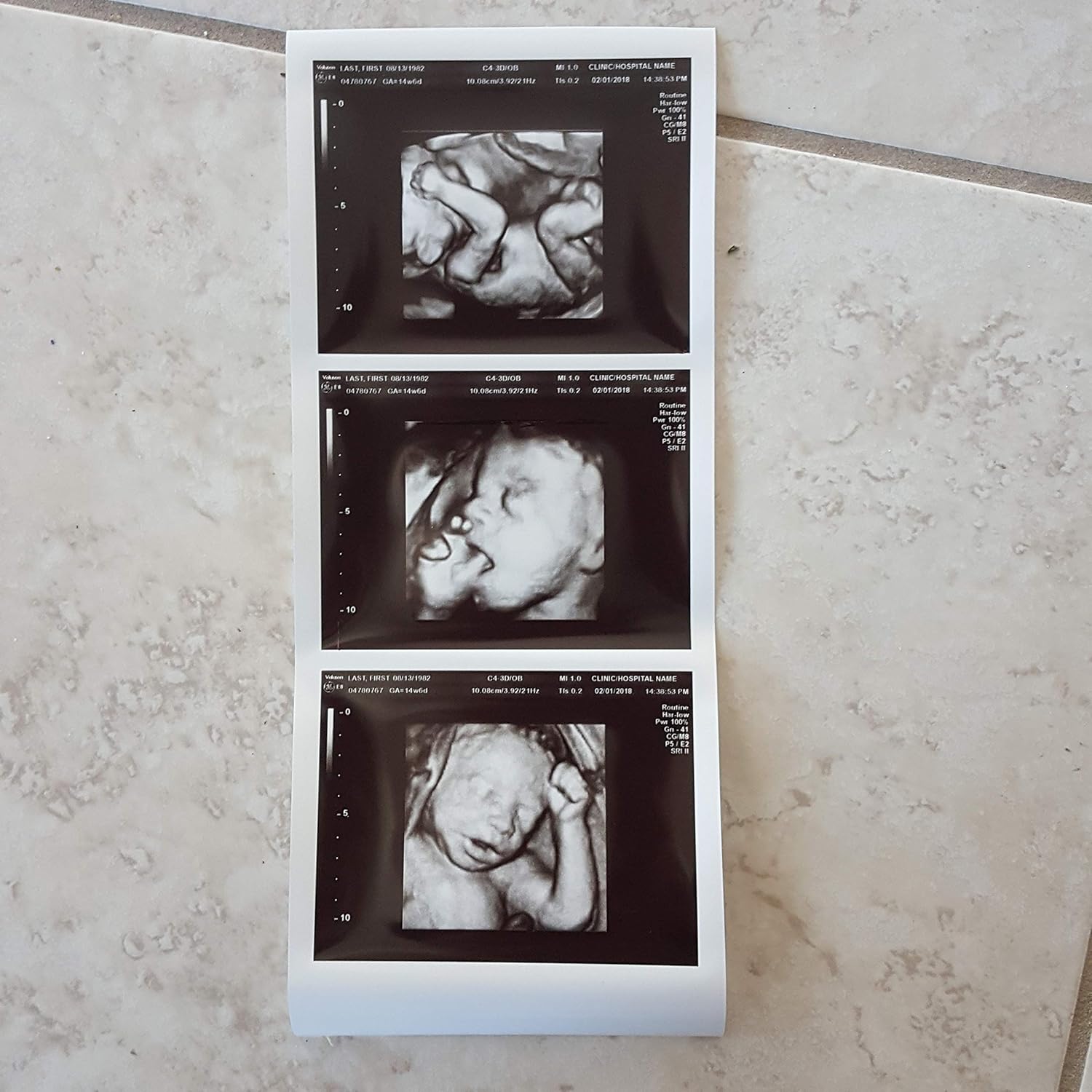 Photographs - Prank 3D Customized Fake Ultrasound Strip of 3 Photos