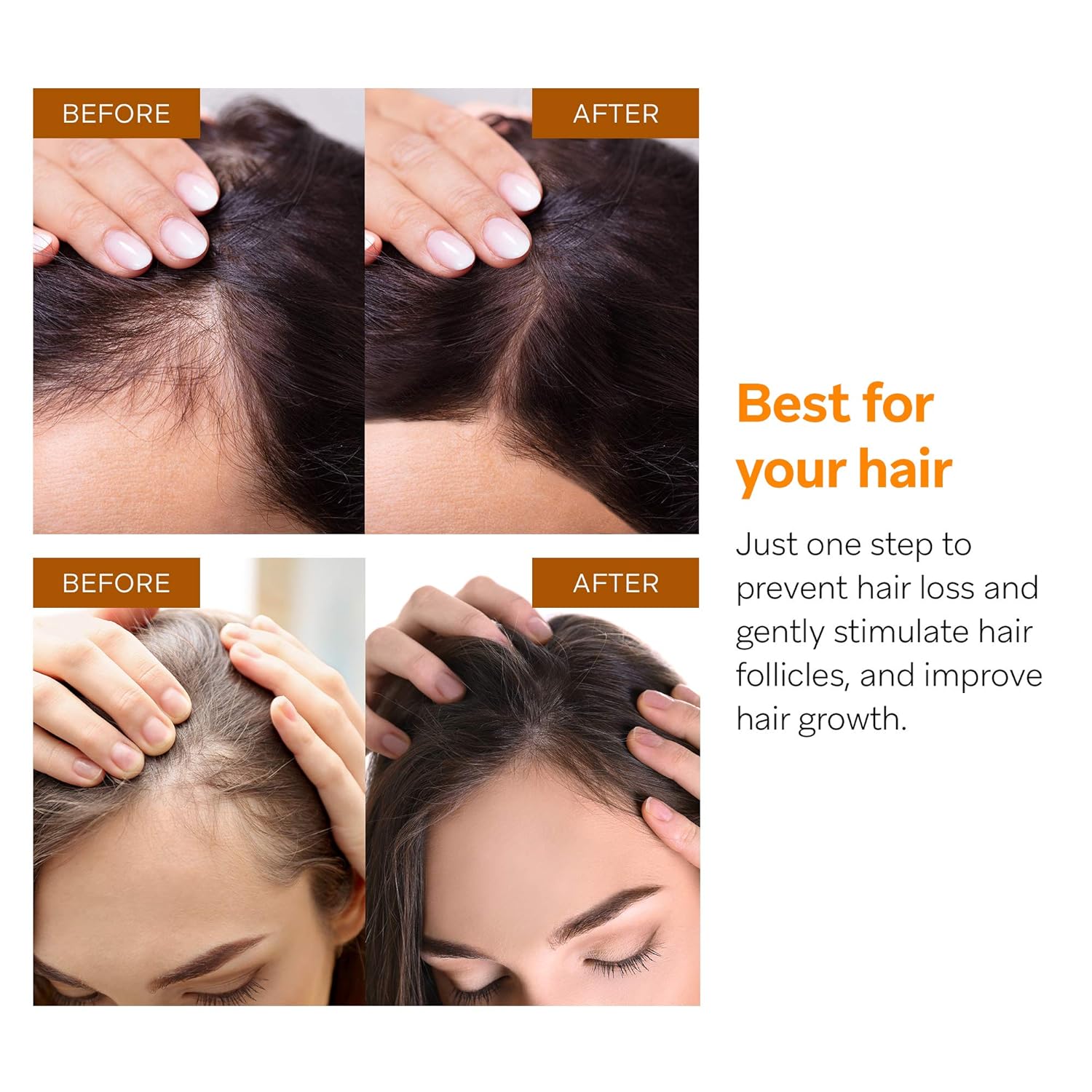 Amazon Com Azally Hair Growth Serum Ginger Hair Growth Oil