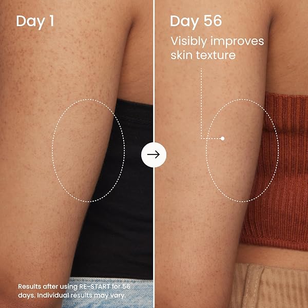MAËLYS RE-START RESURFACING BODY SERUM – AHA EXFOLIATING TREATMENT WITH HYALURONIC FUSION, GLYCOLIC ACID, AND NIACINAMIDE FOR BUMPY SKIN AND UNEVEN TEXTURE (3.5 FL OZ)