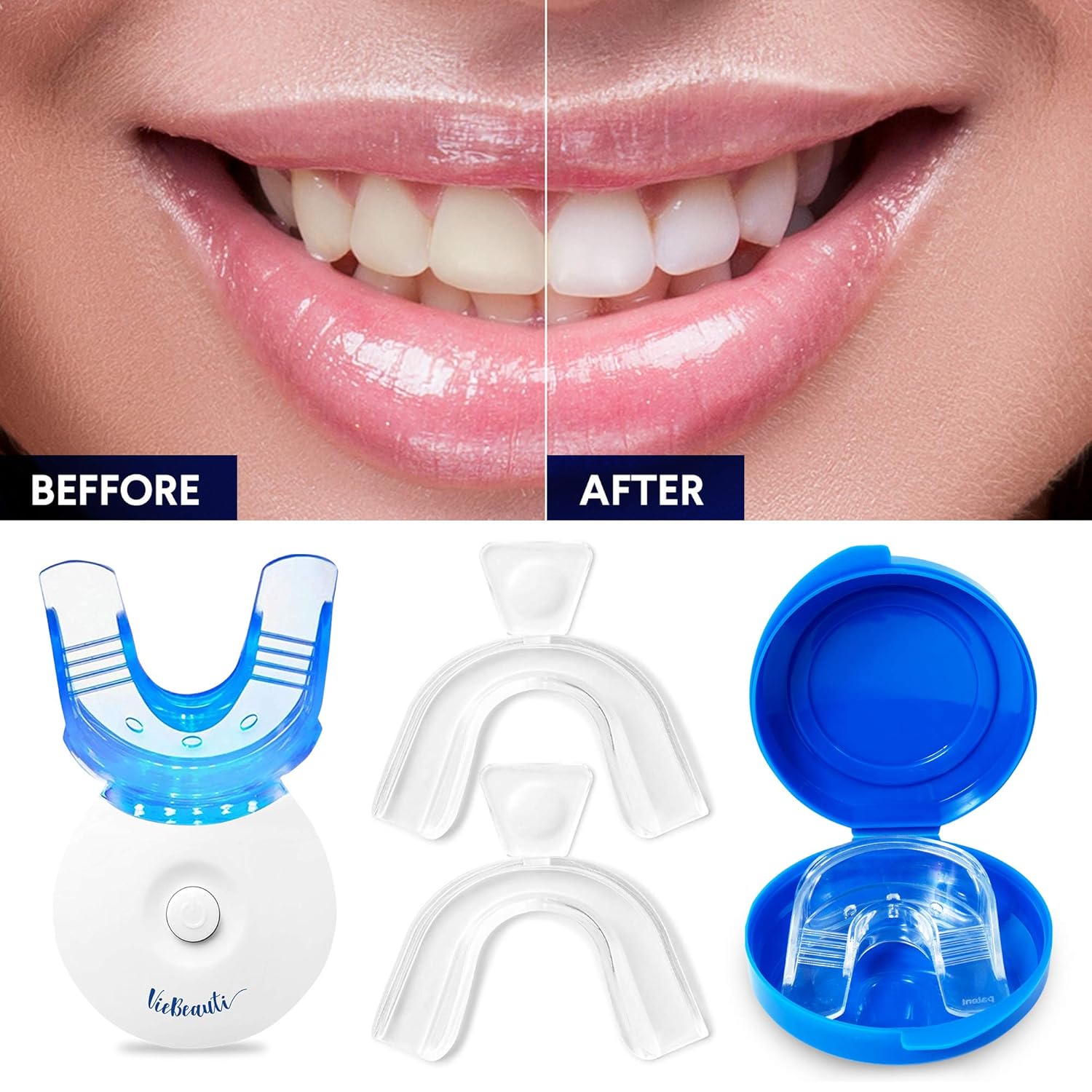 VieBeauti Teeth Whitening Kit - 5X LED Light Tooth Whitener with 35% Carbamide Peroxide, Mouth Trays, Remineralizing Gel and Tray Case - Built-In 10 Minute Timer Restores Your Gleaming White Smile: Beauty