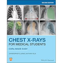 洋書 X-RAY MAGAZINE VOL1 number4 1995 Chest X-Rays for Medical Students: CXRs Made Easy: Clarke