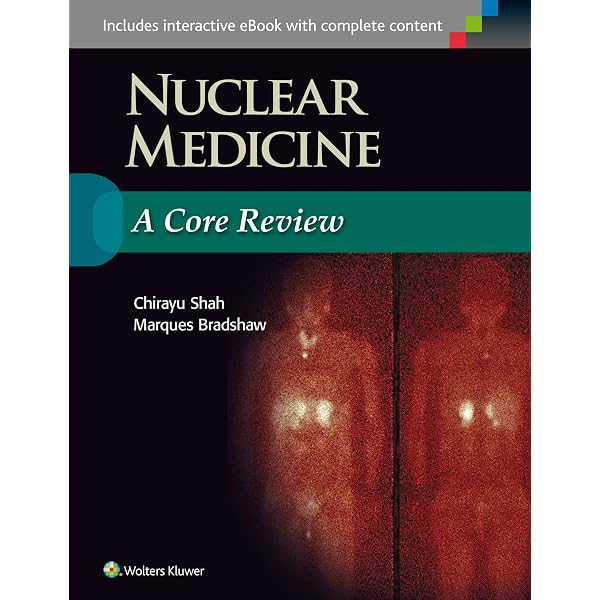 Thoracic Imaging: A Core Review: 9781496347480: Medicine & Health
