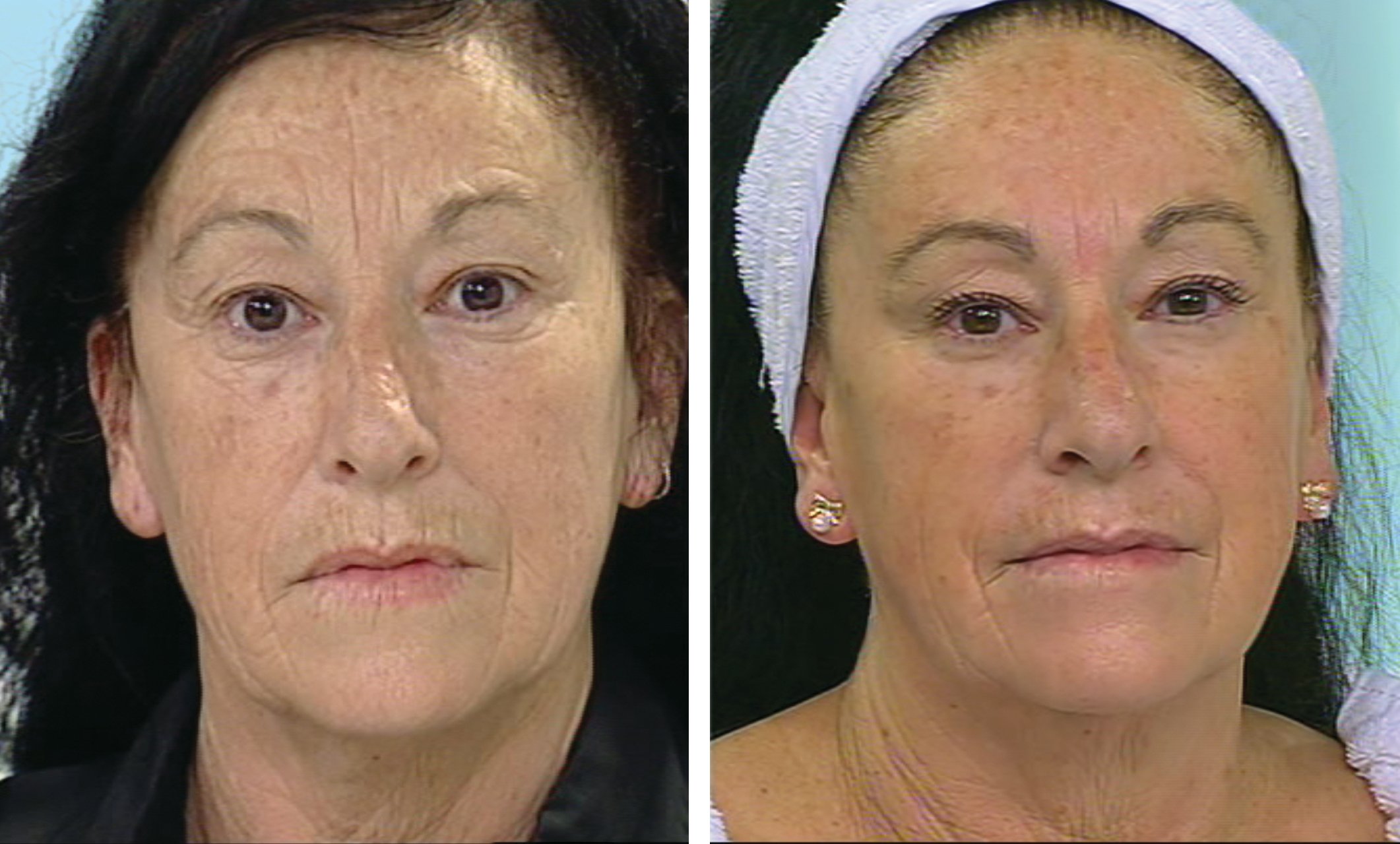 My Perfect Facial Anti Ageing Toning Firming And Tightening Face