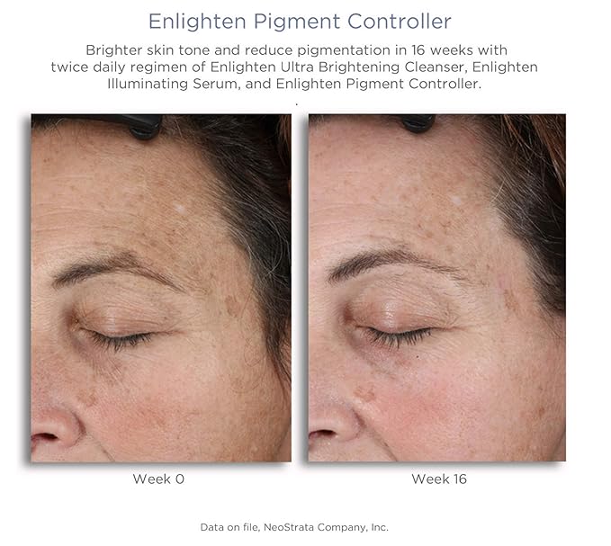 neostrata products for pigmentation