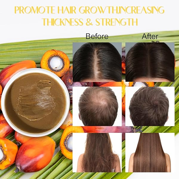 BATANA OIL FOR HAIR GROWTH，100% NATURAL RAW BATANA OIL FROM HONDURAS BATANA HAIR GROWTH OIL PREVENT HAIR LOSS, ELIMINATES SPLIT ENDS FOR MEN & WOMEN 5OZ