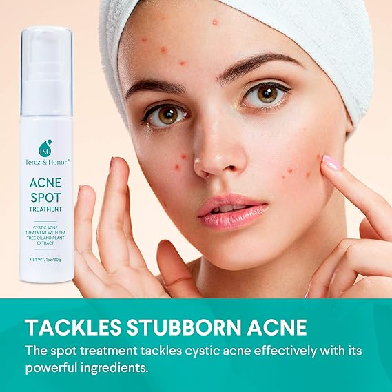 Amazon Com Acne Spot Treatment For Acne Prone Skin Treats Cystic Acne Advanced Acne Removal Fast Acting Pimple Repair With Tea Tree Oil Plant Extract All Natural 30g Beauty