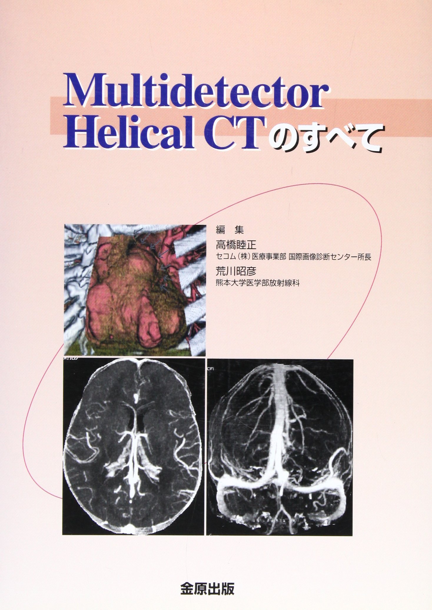 Multidetector Helical Ctのすべて Amazon Com Books