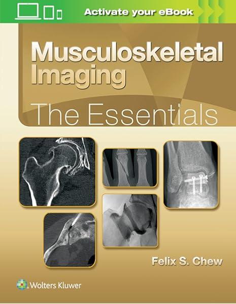 Musculoskeletal Imaging The Essentials 9781496383839 Medicine Health Science Books Amazon Com