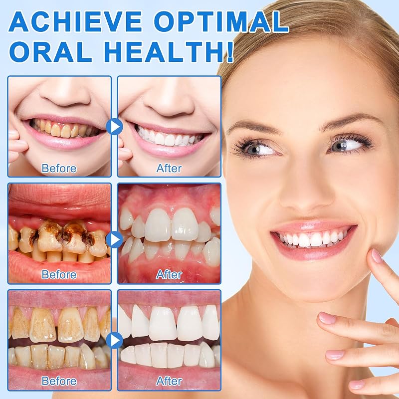 Hydroxylapatite Dentifrice à 9,9% Lot de 2, Dentifrice à L'hydroxyapatite Nano Sans Fluor, Aide à Reminéralisation, Protège L'émail, Soulage la Sensibilité, Renforce Dents, Soins Buccaux Quotidiens