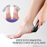 BarberBoss Electric Foot File QR-5086 - Premium Hard Skin Remover view 5