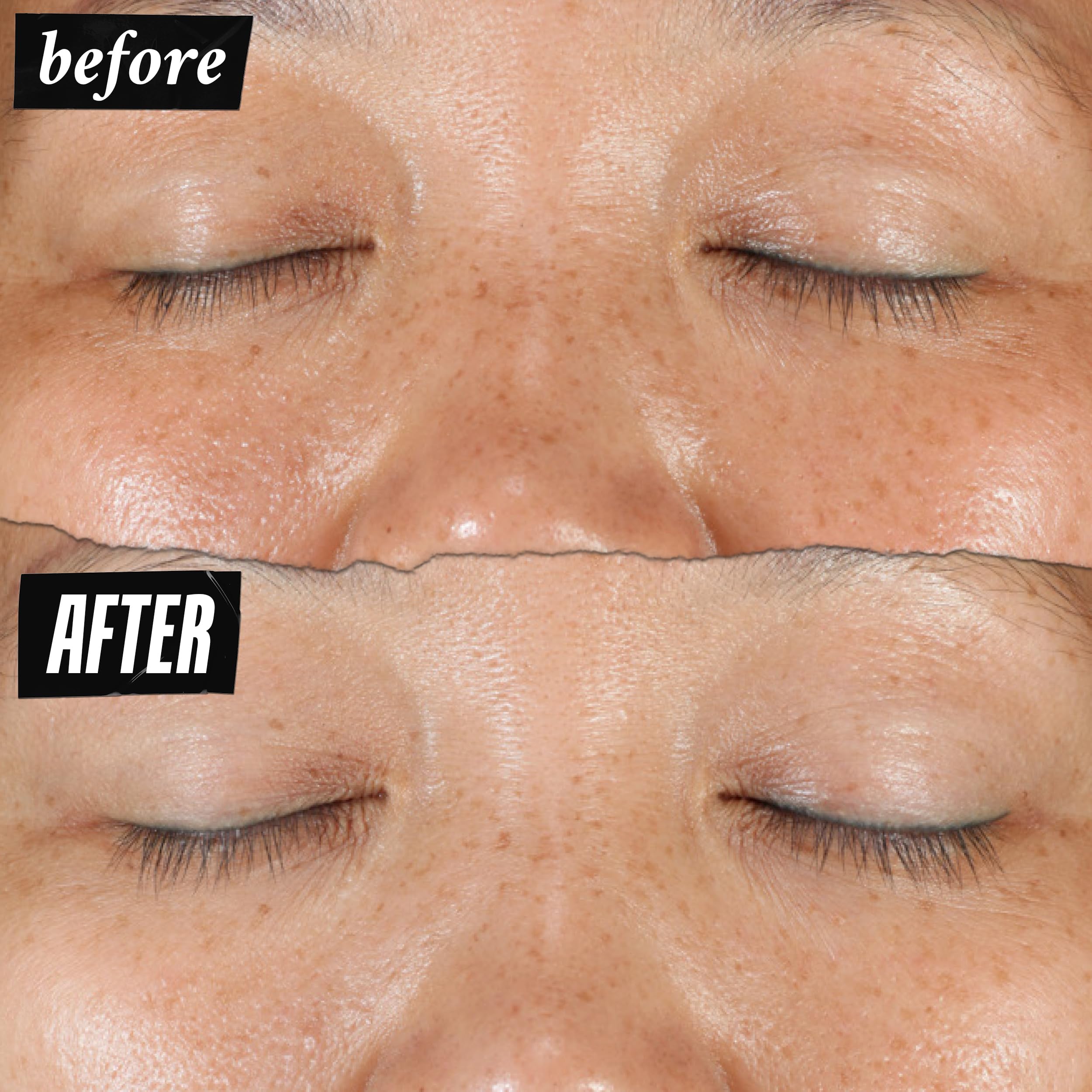 Kiehl's Clearly Corrective Dark Spot Serum, Brightening Facial Serum, Reduces Hyperpigmentation & Post-acne Marks, with Vitamin C & Salicylic Acid, All Skin Types, Paraben-free, Mineral Oil-free