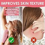 Sibba 6Pcs Exfoliating Gloves Body Scrub Mitts for Shower & Spa view 3