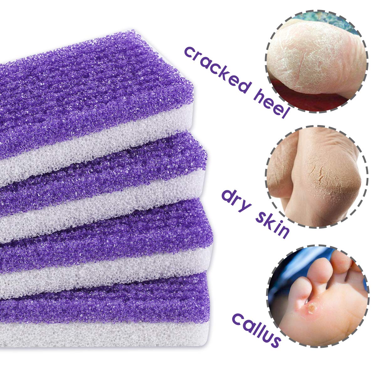 7Pc Foot Pumice Stone for Feet Hard Skin Callus Remover, 2 in 1 Foot Pumice Stone, Double Sided Hard Skin Callus Remover, Dead Skin Scrubber Pedicure Tools, Hard Skin Callus Remover for Feet and Hands: Beauty