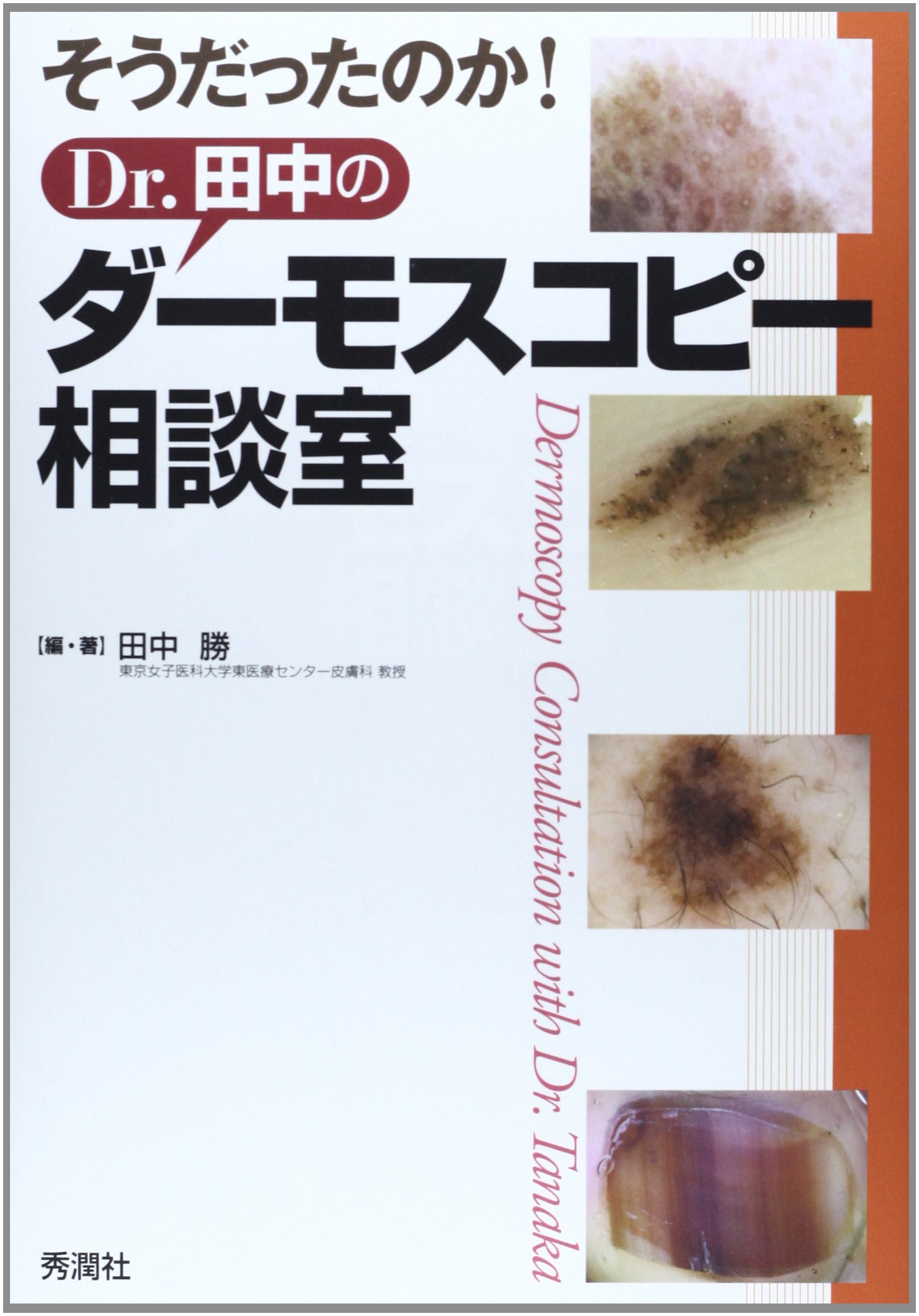 そうだったのか Dr 田中のダーモスコピー相談室 田中 勝 田中 勝 本 通販 Amazon