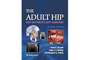 The Adult Hip: Hip Arthroplasty Surgery: eBook without Multimedia