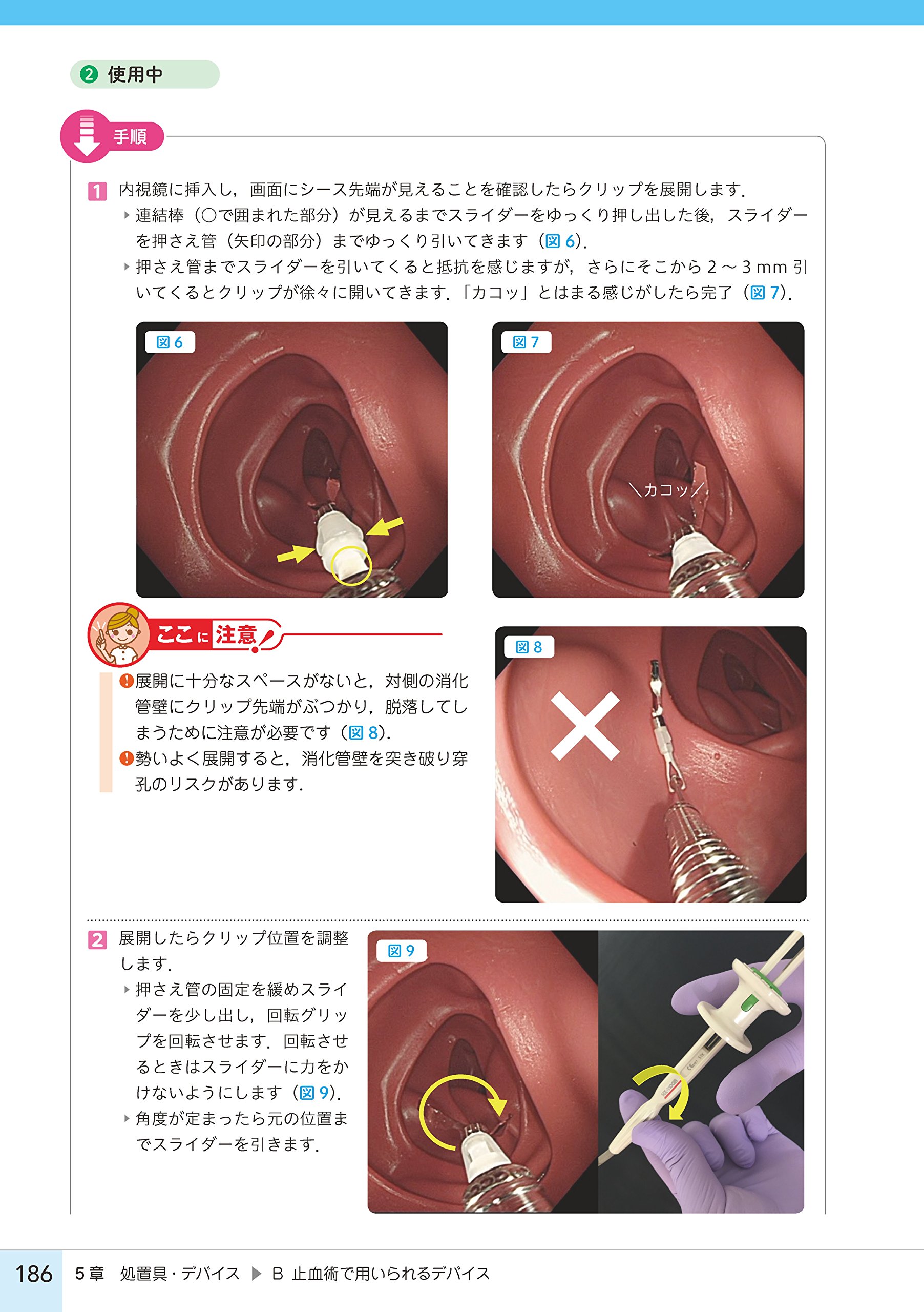 大圃組はやっている 消化器内視鏡の機器 器具 デバイスはこう使え Amazon Com Books