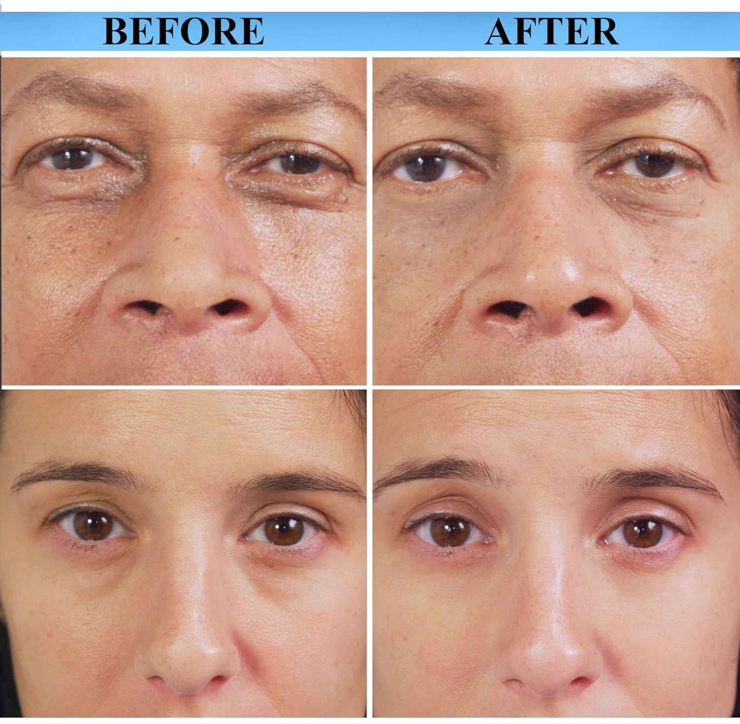 derma rpx fast acting wrinkle reducing cream